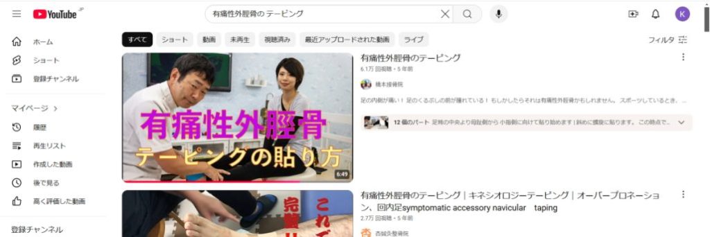 有痛性外脛骨のテーピングと検索して出てくる画像